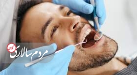 7 مرحله مهم کاشت ایمپلنت دندان - از جراحی تا قالبگیری