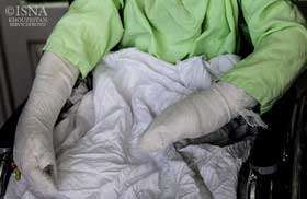 یک پای کودک حادثه دیده از انفجار مین قطع شد