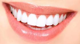 مضرات سفیدکننده‌های دندان