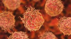 آزمایش جدید برای تشخیص سرطان پروستات