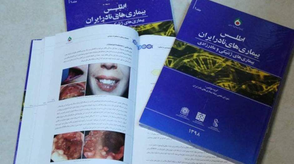 ۳۵۷ بیماری نادر در ایران