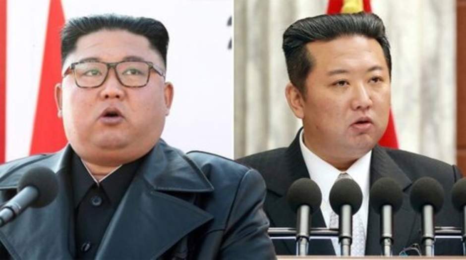 علت کاهش وزن رهبر کره مشخص شد