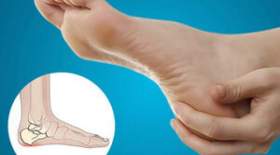روش‌های درمان خار پاشنه