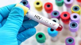 آمار رسمی ابتلا به ایدز در کشور اعلام شد