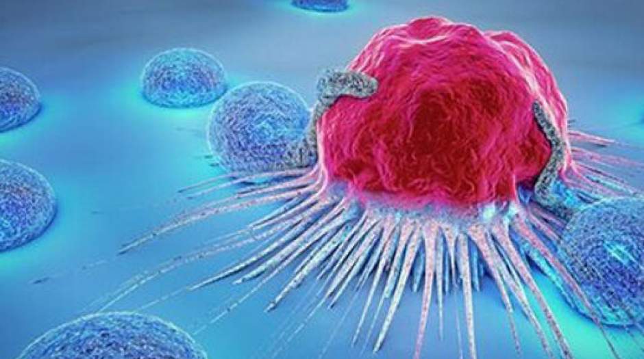 شایع‌ترین نوع سرطان‌ در مردان چیست؟