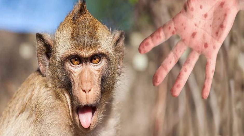 شیوه انتقال آبله میمون تغییر کرده است و دانشمندان دلیل آن را نمی‌دانند!
