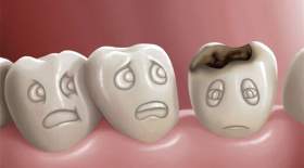 پنج عادت نادرستی که دندان‌هایتان را خراب می‌کند