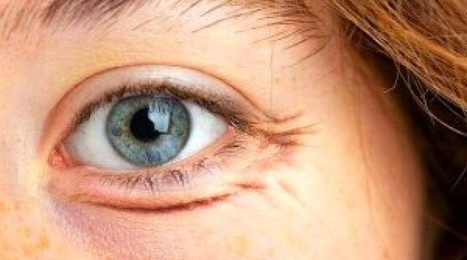 جلوگیری از چروک شدن دور چشم با چند روش ساده