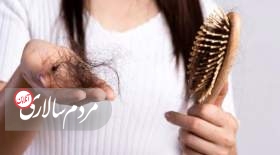 عوامل ریزش مو و راه‌های درمان
