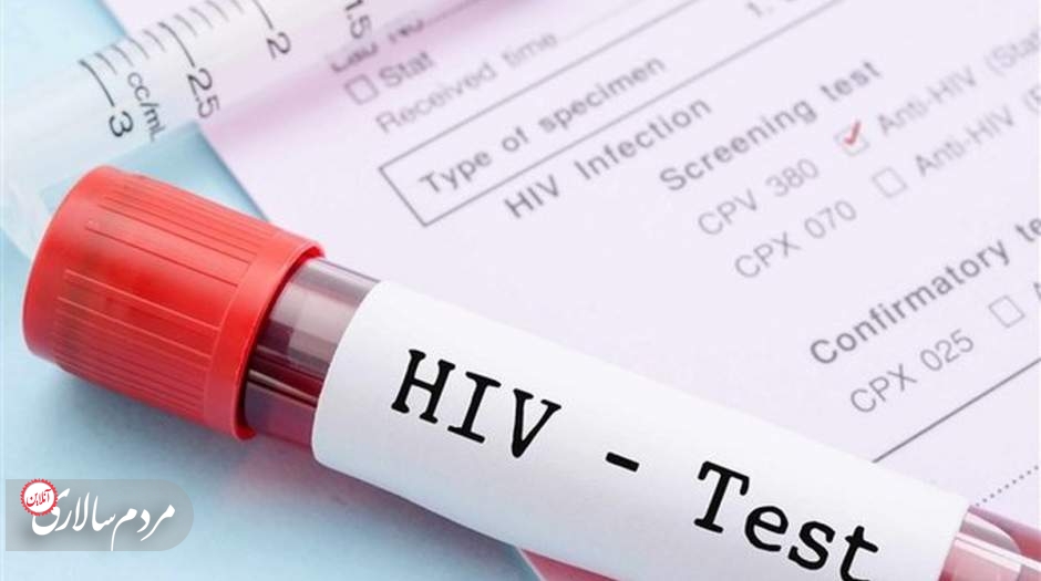 ۵۵ هزار نفر مبتلا به اچ.آی.وی در کشور داریم