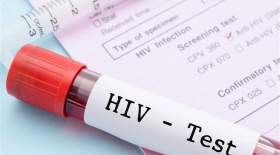 آخرین وضعیت HIV در ایران