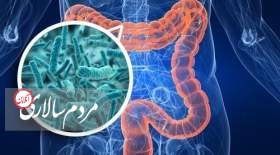 سرطان روده بزرگ چه کسانی را هدف می گیرد؟