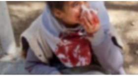 ماجرای صورت خون‌آلود دانش‌آموز اصفهانی چیست؟