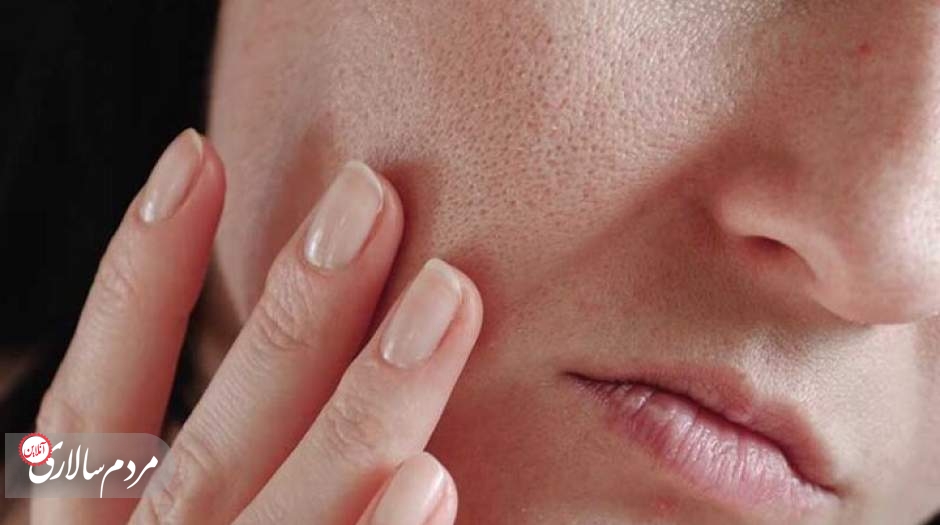 «کورک» چیست؟