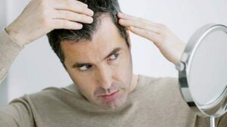دلیل اصلی ریزش موی مردان و زنان