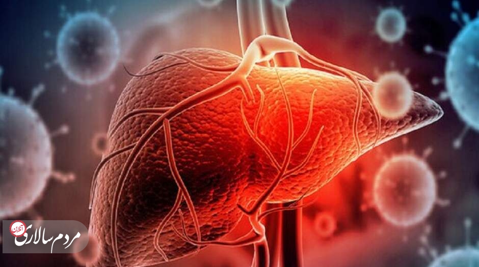 بیماری «کبد چرب» چیست؟