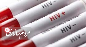 آخرین وضعیت شیوع HIV در ایران