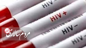 بایدها و نبایدهای تغذیه‌ای برای مبتلایان به ایدز