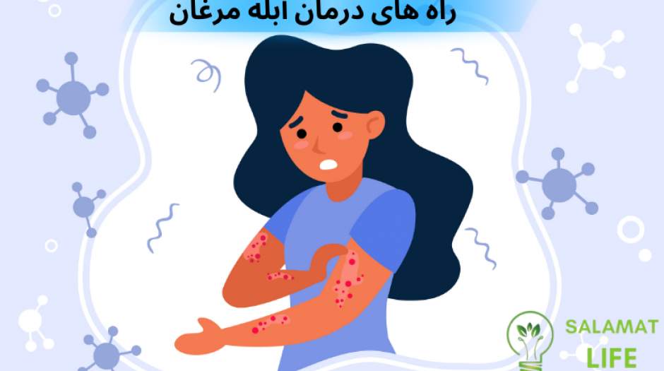 6 روش موثر درمان سریع آبله مرغان در بزرگسالان و کودکان