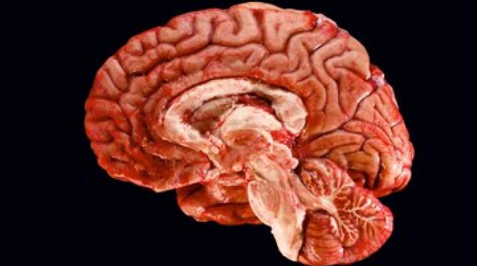تلفن همراه سبب تومور مغزی می‌شود یا نه؟